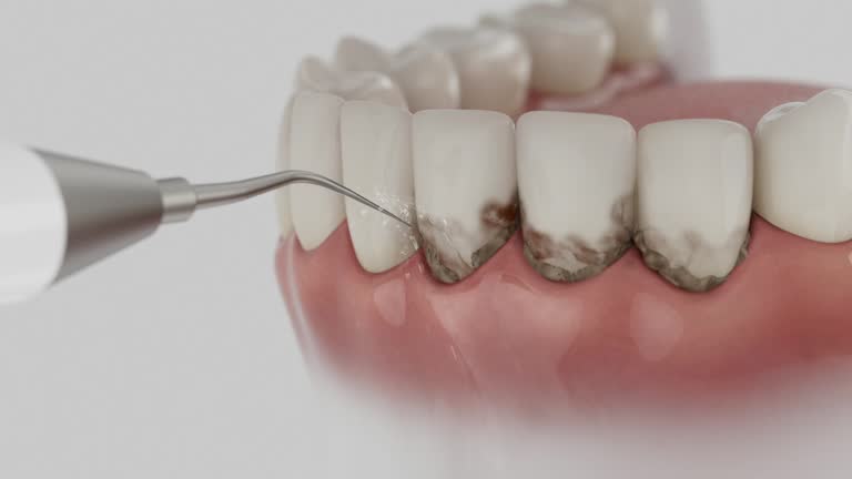Reliable Teeth Cleaning And Checkup contractor in Plano, TX by Smile Center Dentistry